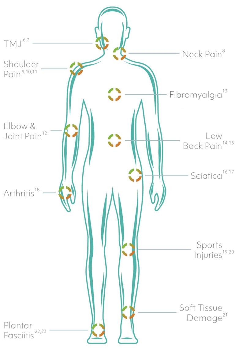 Anatomical image of person with targets- updated Laser Therapy Conditions Treated